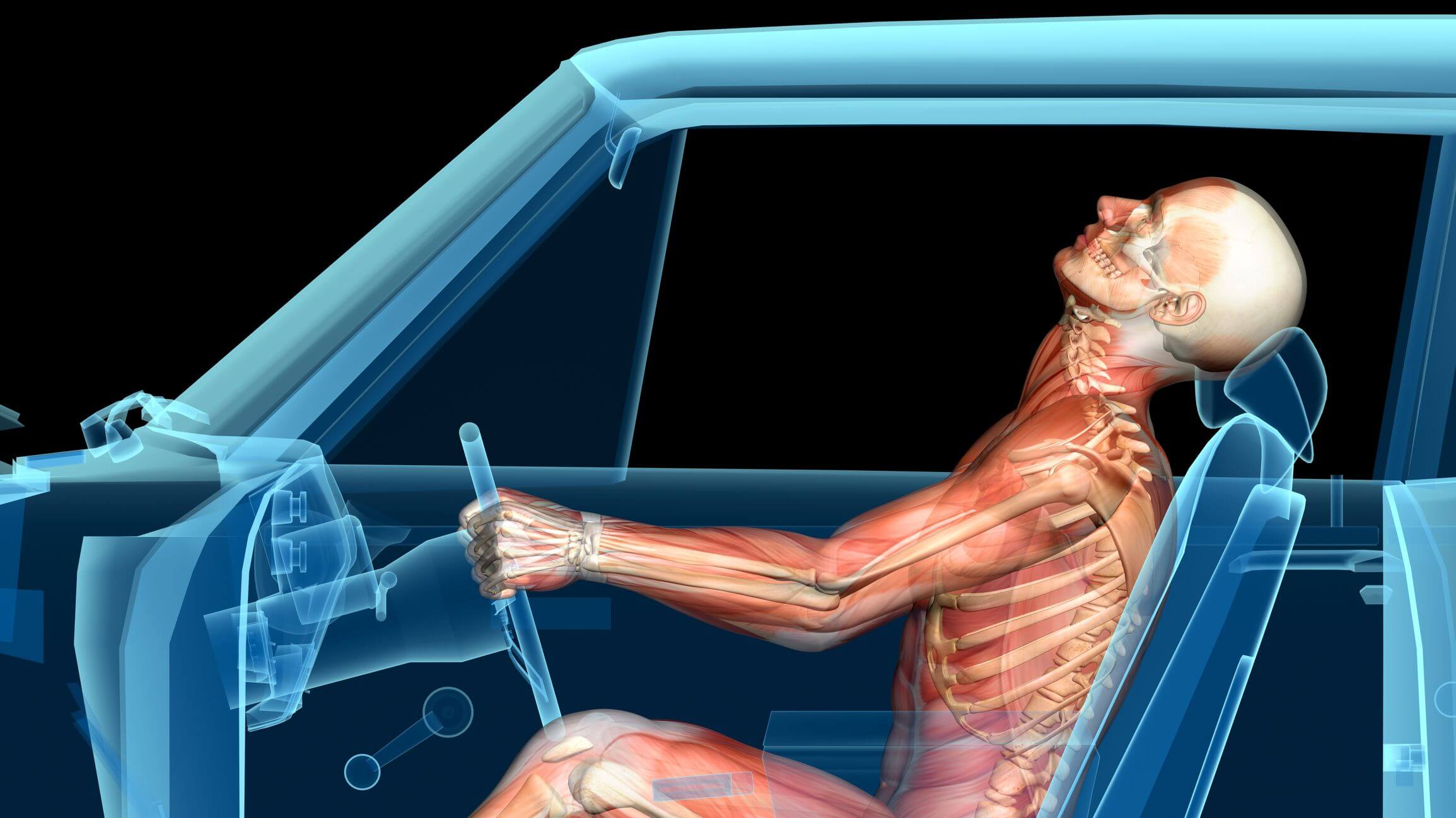 Whiplash Car Accident Settlement